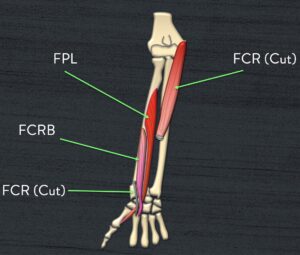 Funky Forearm Muscles