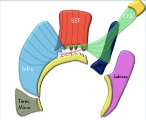 Measuring Retraction of Supraspinatus Tears
