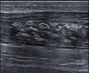 This Changes How You Classify Echogenic Lesions